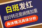 白癜风病情泛发需要我们注意什么?