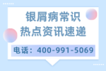 口碑前十：宁波治疗银屑病好的医院（排名一览）光疗治疗银屑病多少钱？