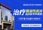 北京哪里治疗脂溢性皮炎-脂溢性皮炎如何保养