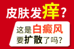 白癜风患者的旅行指南：平安、舒适与乐趣并存