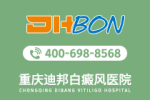 排名快讯！重庆专治白癜风医院“公开揭晓”儿童患白癜风有什么特点