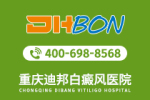 南宁哪家医院白癜风靠谱-南宁西京白癜风医院-儿童患上白癜风要注意什么问题