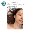 陈卓璇做针灸治疗耳部病情 确诊咽鼓管异常开放症