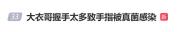 大衣哥握手太多手指被真菌感染 接地气明星的代价