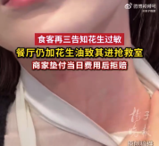 女子说花生过敏饭店加花生油被抢救 饭店拒赔偿