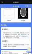 女子突发偏瘫手脚发麻确诊脑出血 熬夜备考成诱因