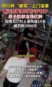6岁孩子被上门争执男子迁怒扇巴掌