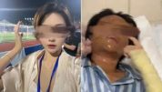 被炸伤女主播否认嫌疑人是榜一大哥 案件即将开庭审理