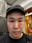 小沈阳一觉睡醒眼睛肿成蜜蜂小狗 名场面笑翻网友
