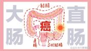 68岁大爷反复腹泻查出结直肠癌 早期信号勿忽视