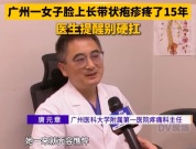别大意！广东女子神经痛当皮肤病硬扛15年 吃饭说话都脸痛