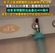 80斤女子便秘揉腹致黄体破裂 医生：腹腔内出血400ml
