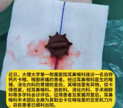 女子喉咙剧痛竟是因误吞豆浆机刀片