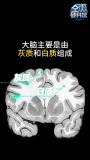 首个中国全年龄大脑“地图” 揭示中西差异