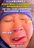 绝地求生！两人从6112米雪山滑坠后奇迹生还