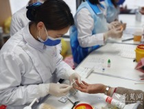 护好“小心肝” 远离“癌”阴影——宜昌市三医院特色诊疗守护百姓肝脏健康