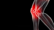 如何治疗膝盖关节痛？西乐葆止痛又治痛，疗效好、更安全