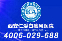 重磅宣布！西安白癜风到哪家专科医院看"详细排名"毛囊型白癜风的临床表现特点