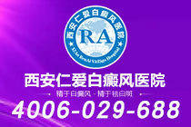 官网通知！西安白癜风专科医院哪家靠谱"实力上榜"晕痣型白癜风有什么症状