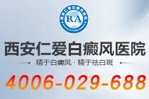榜单速览！西安治白癜风的医院有哪些"名单出炉"为什么白癜风患者要做血液检查