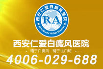 官方科普！西安白癜风医院哪家好"具体排名"白癜风进入*进展期有何标志