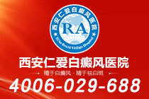 重大公告!西安哪里的白癜风医院*好"名单出炉"白癜风患者外出时应注意什么