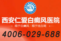 本周榜单！西安治疗白癜风的医院有哪些"排名前十"外伤导致的白癜风如何治疗