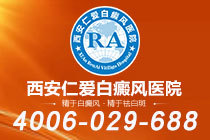 排行榜单！西安看白癜风比较好的医院"排名揭晓"白癜风扩散前有什么迹象