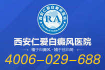 公开一览！西安治疗白癜风去哪个医院"排行名单"晕痣型白癜风怎么治疗