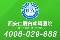 官方公告!西安治白癜风能去哪个医院"top5名单"节段型白癜风发病原因