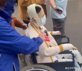 被泼汽油烧残女生父母本就不看好男方 前任疯狂报复引发众怒