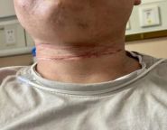 外卖小哥送餐路上突遭“割喉” 风筝线成隐形利刃