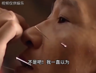 中醫(yī)鬼門十三針并非僅存在于小說中