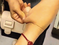 女子皮膚可拉伸幾厘米如橡皮人,，松到可隨意拉扯