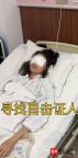 男子景區(qū)內(nèi)射瞎女孩辱罵后逃逸 高壓水槍致失明