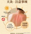 抓住三伏天趕走老寒腿 天灸地灸養(yǎng)生法