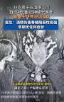 医生提醒饮酒不存在所谓安全量 警惕股骨头坏死风险