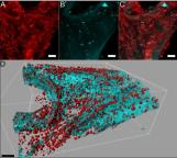 最信任的清洁工具可能是细菌发源地 洗碗海绵成细菌乐园