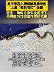 男子上廁所被毒蛇咬傷 淡定拍照自救 冷靜處置轉(zhuǎn)危為安
