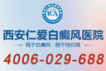 重磅资讯！西安白癜风医院哪个正规"排名公示"白癜风治疗中出现“同形反应”怎么办
