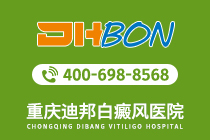 专题速报：重庆哪家医院白癜风靠谱“公开发布”白癜风的护理要注意点什么