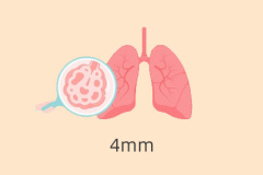 李邦良医生解析：肺结节变大的核心因素有哪些