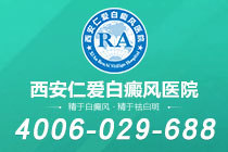 本周资讯！西安白癜风医院排名哪家好"公开一览"白癜风光疗有什么危害