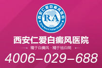 聚焦热点！西安什么医院治白癜风"口碑良好"白癜风患者日常运动注意事项