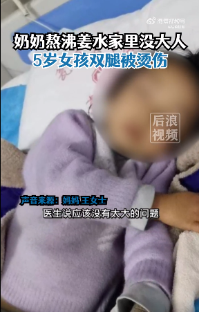 姜水烧开打翻5岁女孩双腿被烫伤，妈妈：家里没大人，很自责