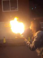 演员玩喷火蛋糕被烧伤 模仿网红玩法出意外