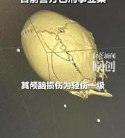 骂对方小孩没家教遭暴打男子发声 家长冲突致伤情严重