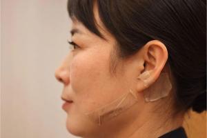 女警称如果脸上不留疤心中会留疤 英勇事迹感动人心