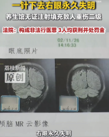 无资质养生馆扎瞎顾客右眼致其失明 3人获刑