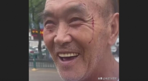 拉车老人被女子殴打获赔300块！满脸是血还笑的那么和善！